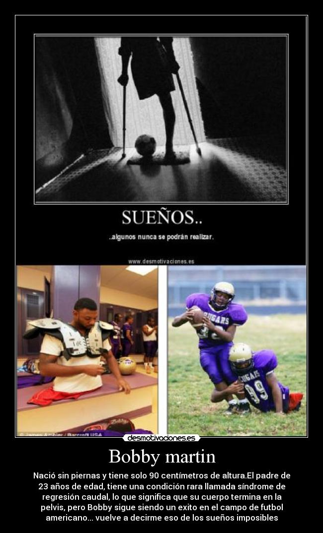Bobby martin - Nació sin piernas y tiene solo 90 centímetros de altura.El padre de
23 años de edad, tiene una condición rara llamada síndrome de
regresión caudal, lo que significa que su cuerpo termina en la
pelvis, pero Bobby sigue siendo un exito en el campo de futbol
americano... vuelve a decirme eso de los sueños imposibles