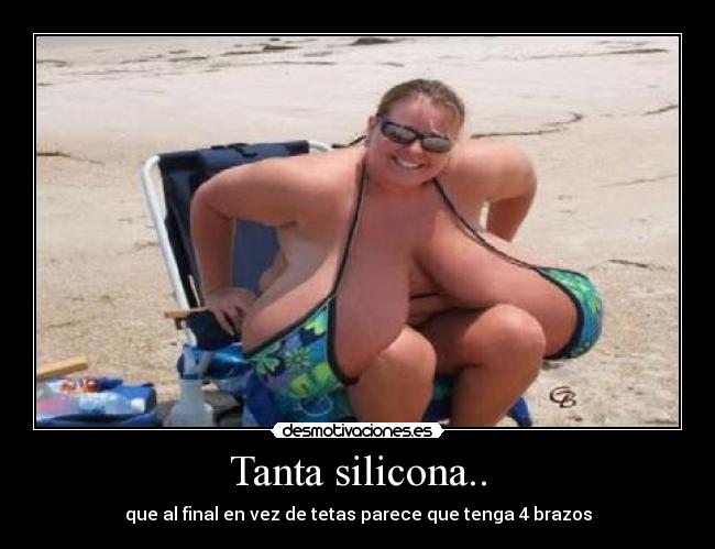 Tanta silicona.. -