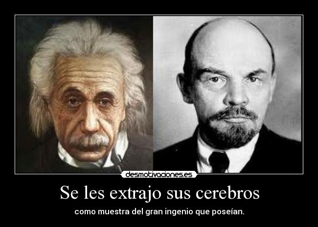 Se les extrajo sus cerebros - como muestra del gran ingenio que poseían.