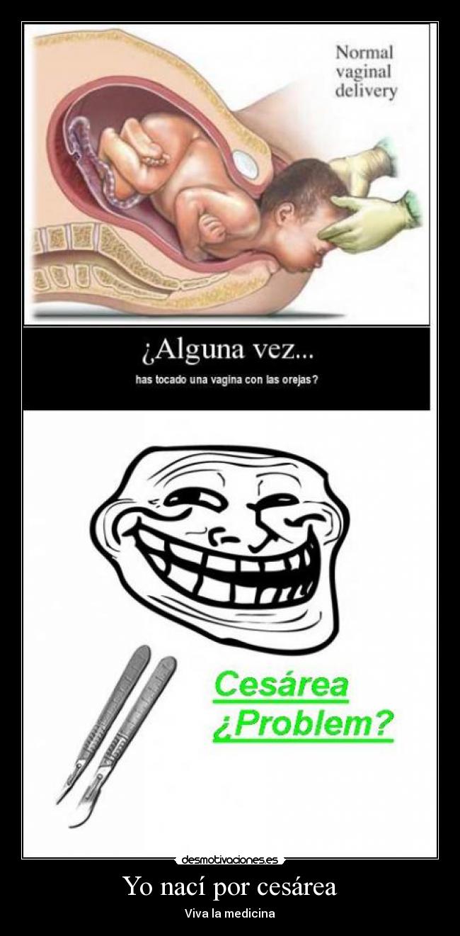 carteles cesarea troll desmotivaciones
