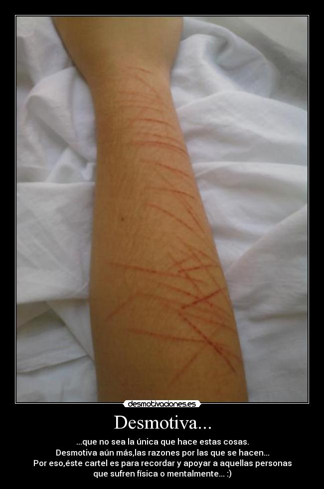 Desmotiva... - ...que no sea la única que hace estas cosas.
Desmotiva aún más,las razones por las que se hacen...
Por eso,éste cartel es para recordar y apoyar a aquellas personas
que sufren física o mentalmente... :)