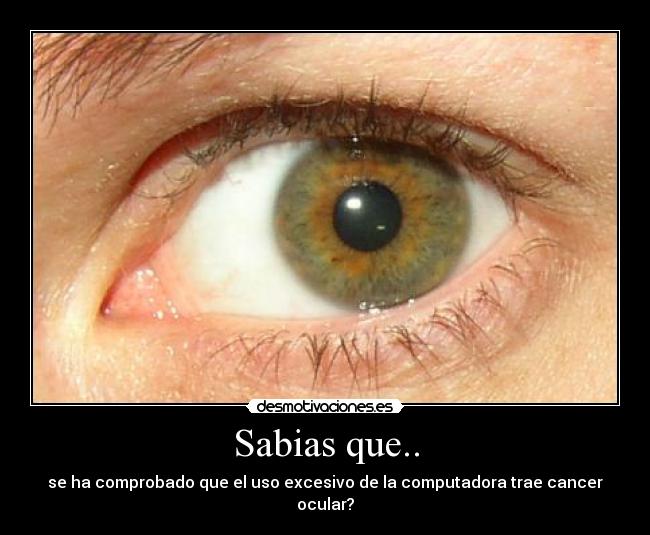 Sabias que.. - se ha comprobado que el uso excesivo de la computadora trae cancer ocular?