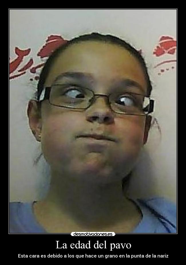 La edad del pavo - Esta cara es debido a los que hace un grano en la punta de la nariz