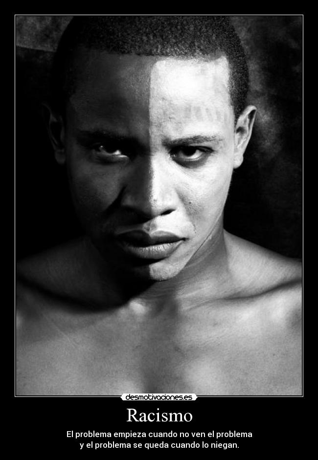 Racismo - 