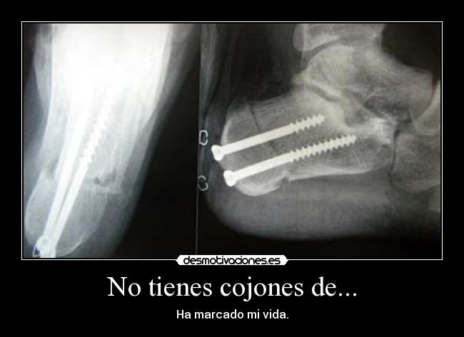 No tienes cojones de... - 