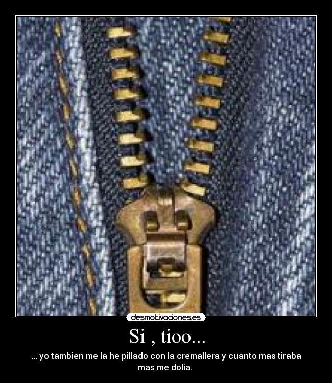 Si , tioo... - ... yo tambien me la he pillado con la cremallera y cuanto mas tiraba mas me dolia.