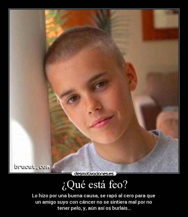 ¿Qué está feo? - Lo hizo por una buena causa, se rapó al cero para que
un amigo suyo con cáncer no se sintiera mal por no
tener pelo, y, aún así os burlais...