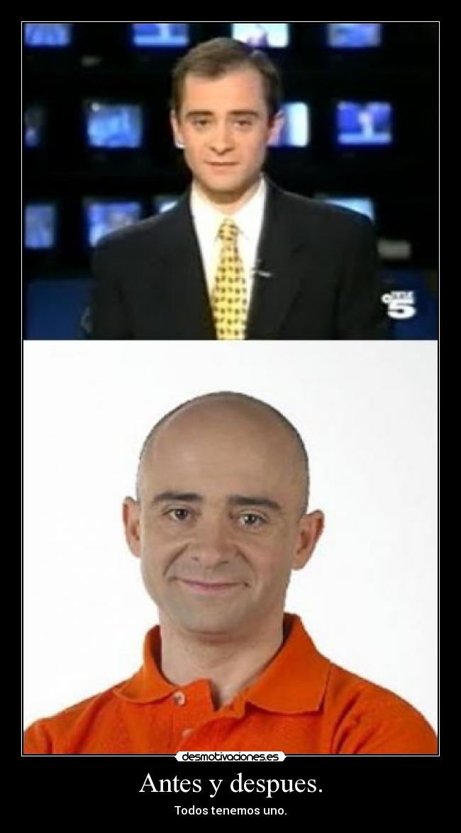 Antes y despues. - 