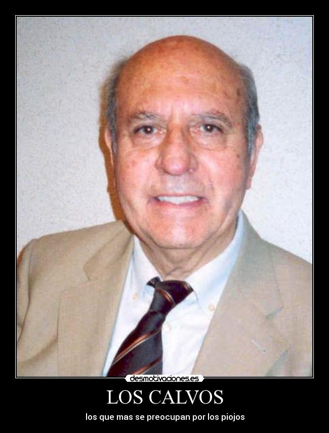LOS CALVOS -