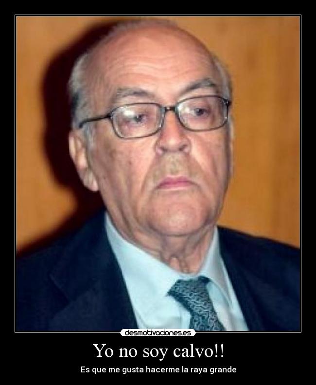 Yo no soy calvo!! -