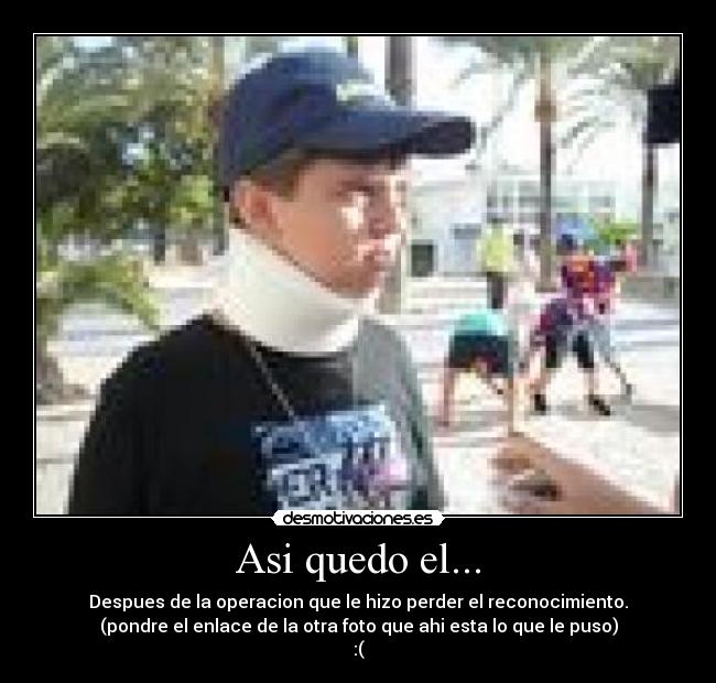 Asi quedo el... - Despues de la operacion que le hizo perder el reconocimiento.
(pondre el enlace de la otra foto que ahi esta lo que le puso)
:(