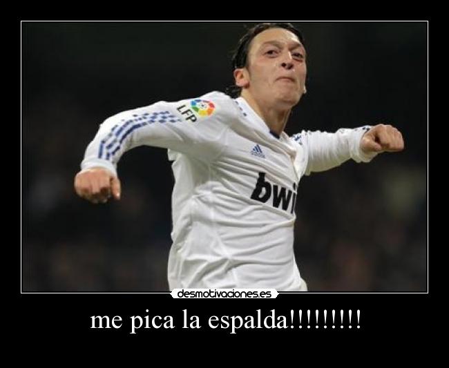 me pica la espalda!!!!!!!!! -