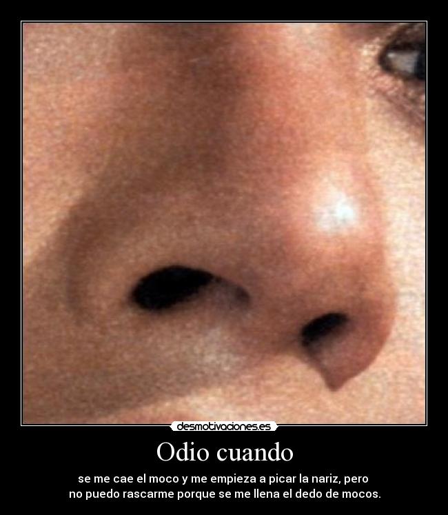 Odio cuando - se me cae el moco y me empieza a picar la nariz, pero
no puedo rascarme porque se me llena el dedo de mocos.