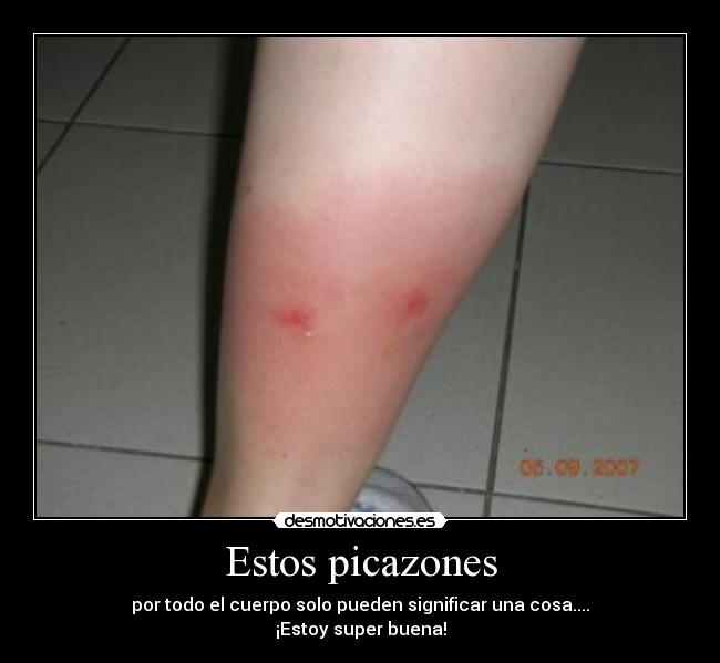 Estos picazones -