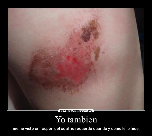 Yo tambien - 