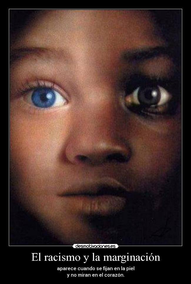 El racismo y la marginación -