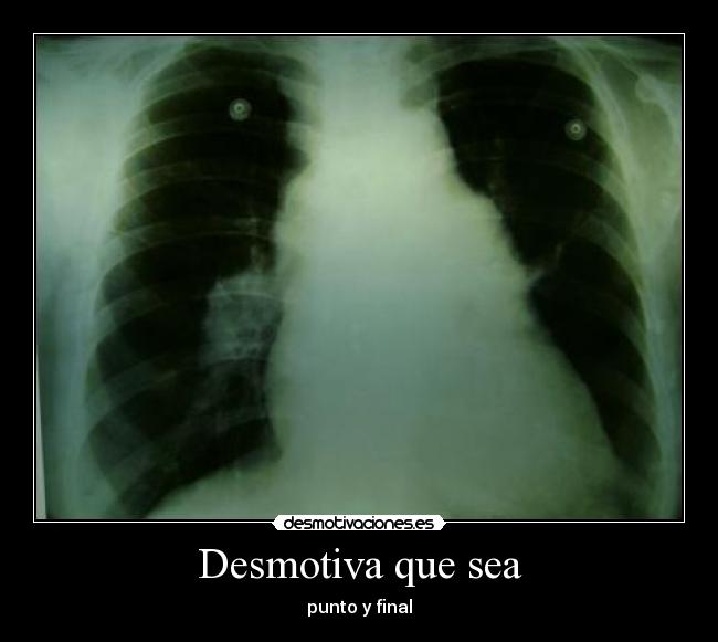 Desmotiva que sea -