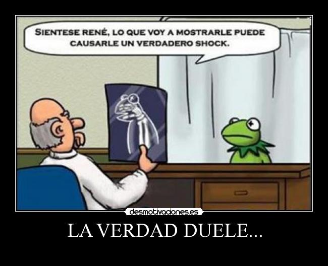 LA VERDAD DUELE... -
