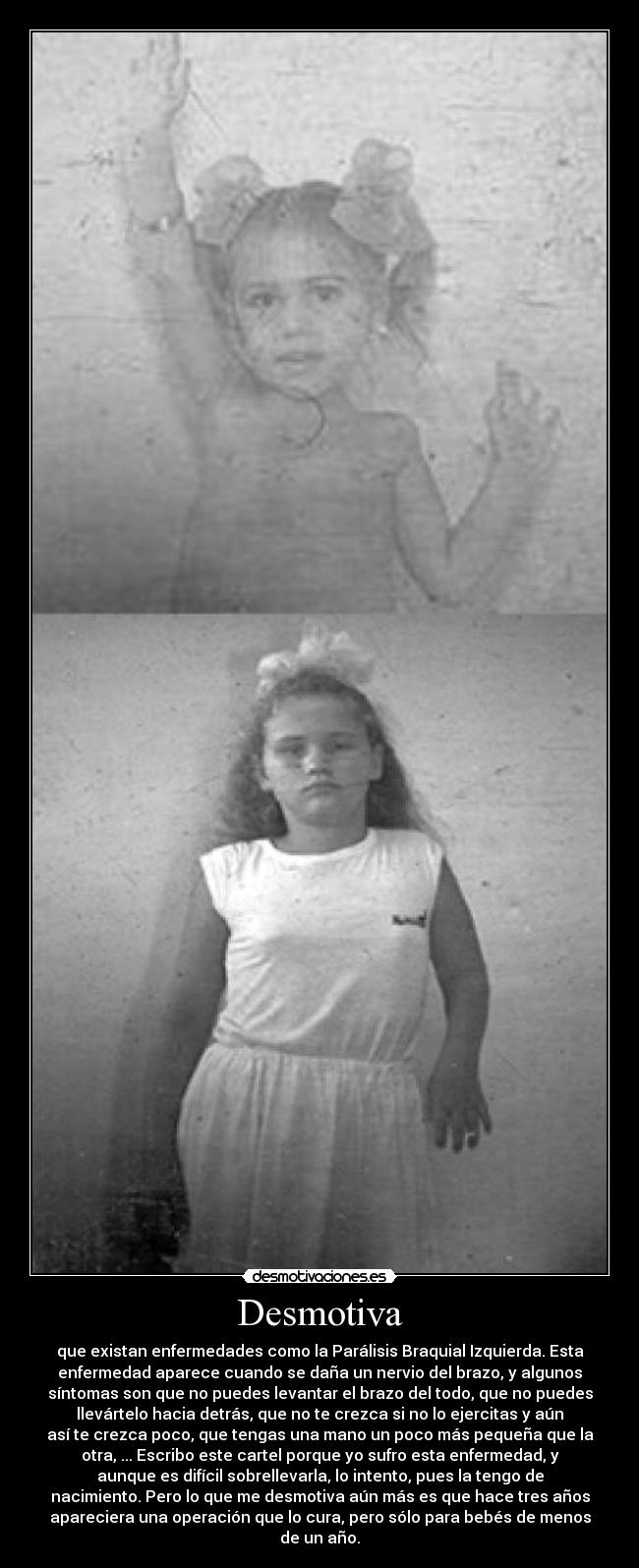 Desmotiva - que existan enfermedades como la Parálisis Braquial Izquierda. Esta
enfermedad aparece cuando se daña un nervio del brazo, y algunos
síntomas son que no puedes levantar el brazo del todo, que no puedes
llevártelo hacia detrás, que no te crezca si no lo ejercitas y aún
así te crezca poco, que tengas una mano un poco más pequeña que la
otra, ... Escribo este cartel porque yo sufro esta enfermedad, y
aunque es difícil sobrellevarla, lo intento, pues la tengo de
nacimiento. Pero lo que me desmotiva aún más es que hace tres años
apareciera una operación que lo cura, pero sólo para bebés de menos
de un año.