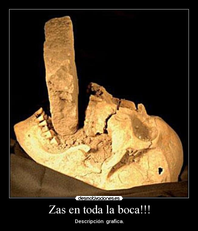 Zas en toda la boca!!! - 