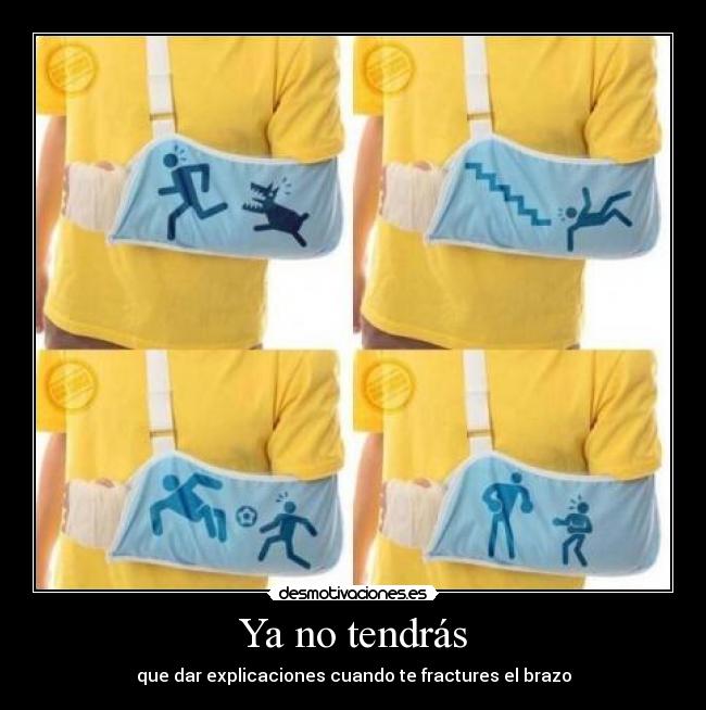 Ya no tendrás - que dar explicaciones cuando te fractures el brazo