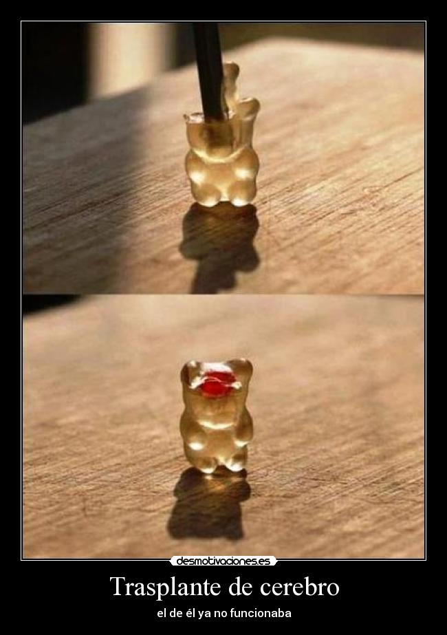 Trasplante de cerebro - el de él ya no funcionaba