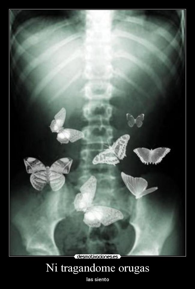 Ni tragandome orugas - 