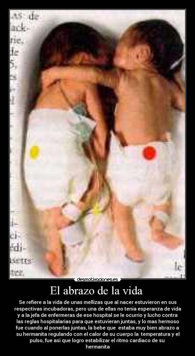 El abrazo de la vida - Se refiere a la vida de unas mellizas que al nacer estuvieron en sus
respectivas incubadoras, pero una de ellas no tenia esperanza de vida
y a la jefa de enfermeras de ese hospital se le ocurrio y lucho contra
las reglas hospitalarias para que estuvieran juntas, y lo mas hermoso
fue cuando al ponerlas juntas, la bebe que estaba muy bien abrazo a
su hermanita regulando con el calor de su cuerpo la temperatura y el
pulso, fue asi que logro estabilizar el ritmo cardiaco de su
hermanita