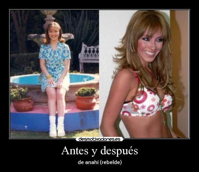 Antes y después - de anahí (rebelde)