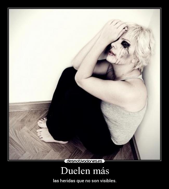 Duelen más -