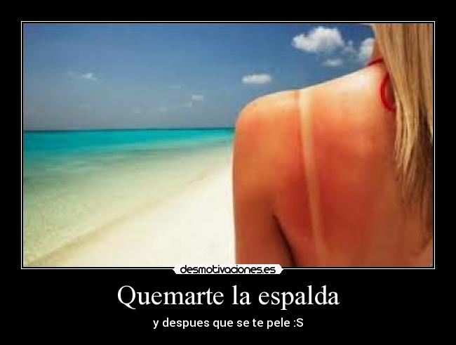 Quemarte la espalda - y despues que se te pele :S