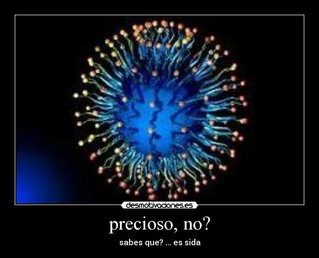 precioso, no? - sabes que? ... es sida