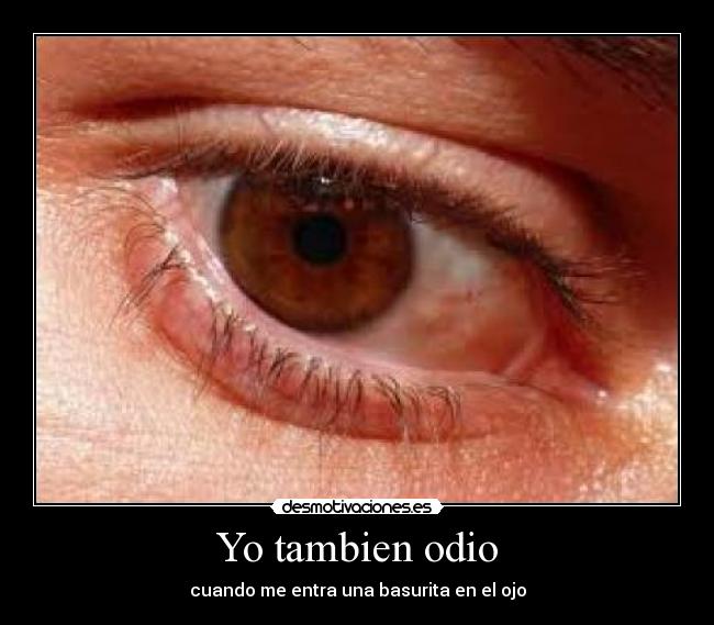 Yo tambien odio -