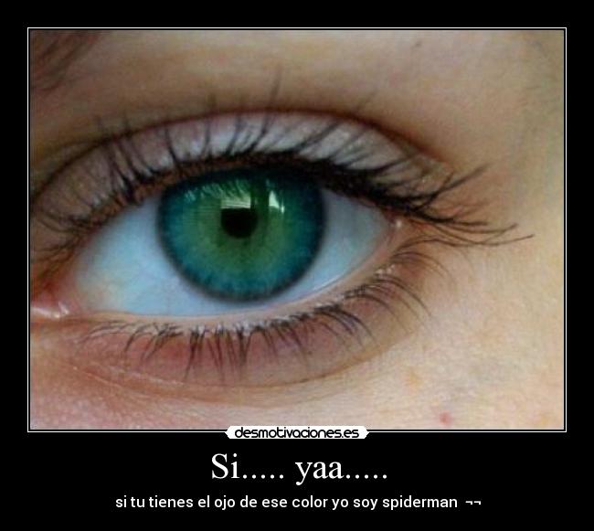 Si..... yaa..... - si tu tienes el ojo de ese color yo soy spiderman  ¬¬