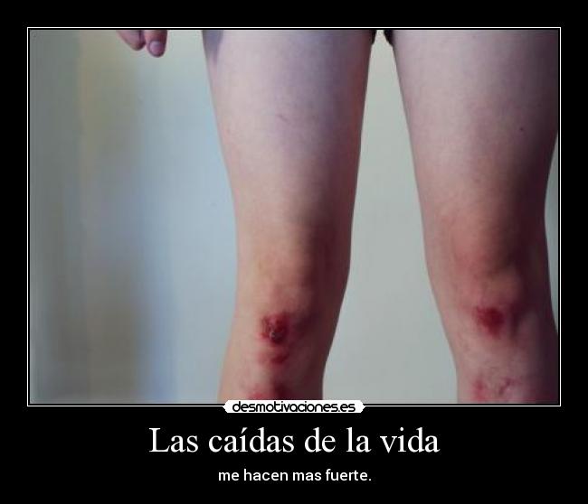 Las caídas de la vida - me hacen mas fuerte.