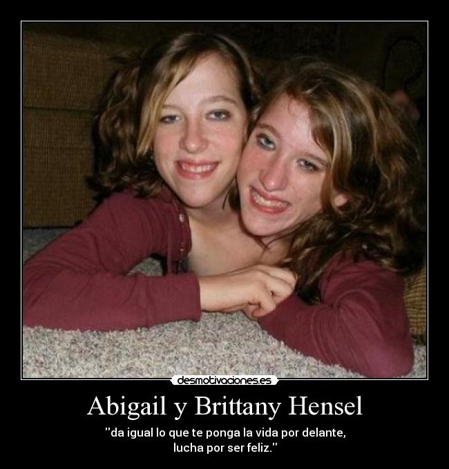 Abigail y Brittany Hensel - da igual lo que te ponga la vida por delante,
lucha por ser feliz.
