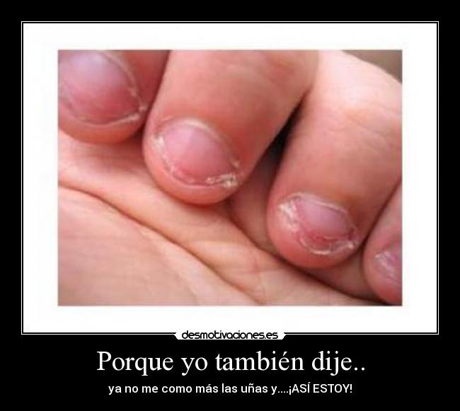 Porque yo también dije.. - ya no me como más las uñas y....¡ASÍ ESTOY!