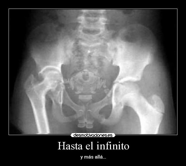 Hasta el infinito -