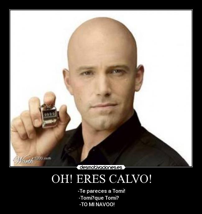 OH! ERES CALVO! - -Te pareces a Tomi!
-Tomi?que Tomi?    
-TO MI NAVOO!       