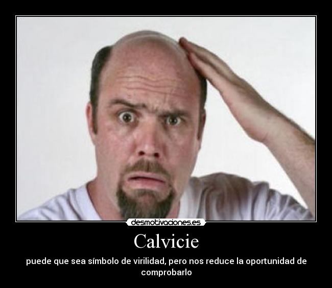 Calvicie - puede que sea símbolo de virilidad, pero nos reduce la oportunidad de comprobarlo