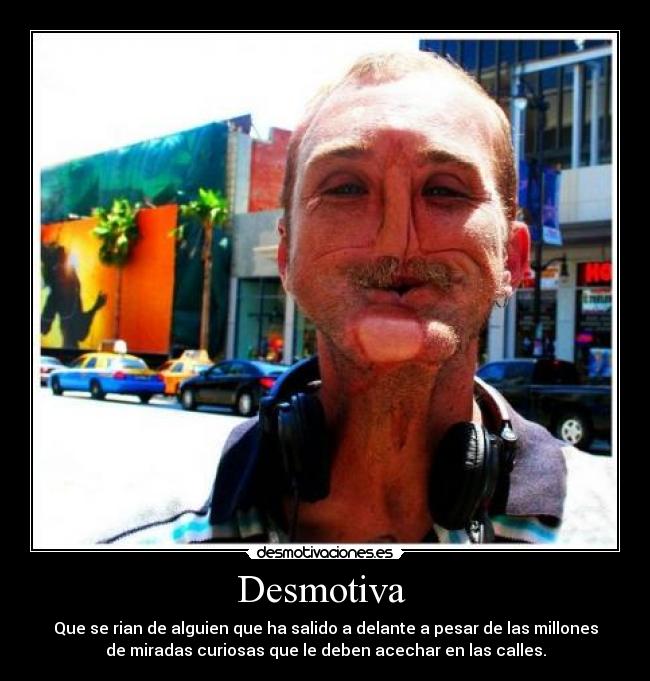 Desmotiva - Que se rian de alguien que ha salido a delante a pesar de las millones
de miradas curiosas que le deben acechar en las calles.