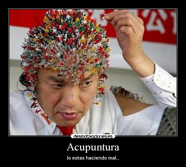 Acupuntura - lo estas haciendo mal...