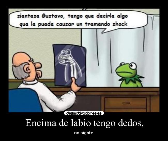 Encima de labio tengo dedos, - no bigote