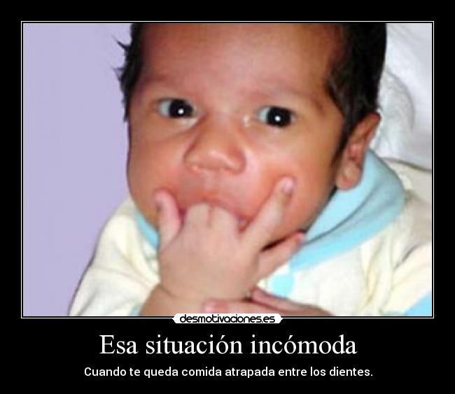 Esa situación incómoda - Cuando te queda comida atrapada entre los dientes.