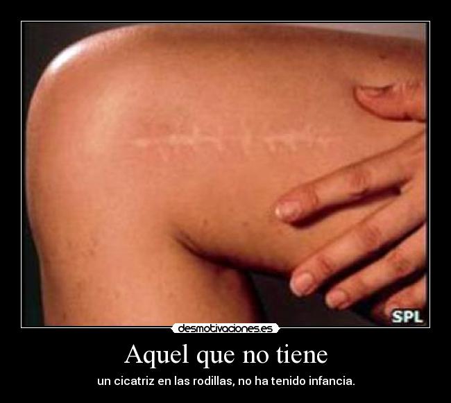 Aquel que no tiene - un cicatriz en las rodillas, no ha tenido infancia.