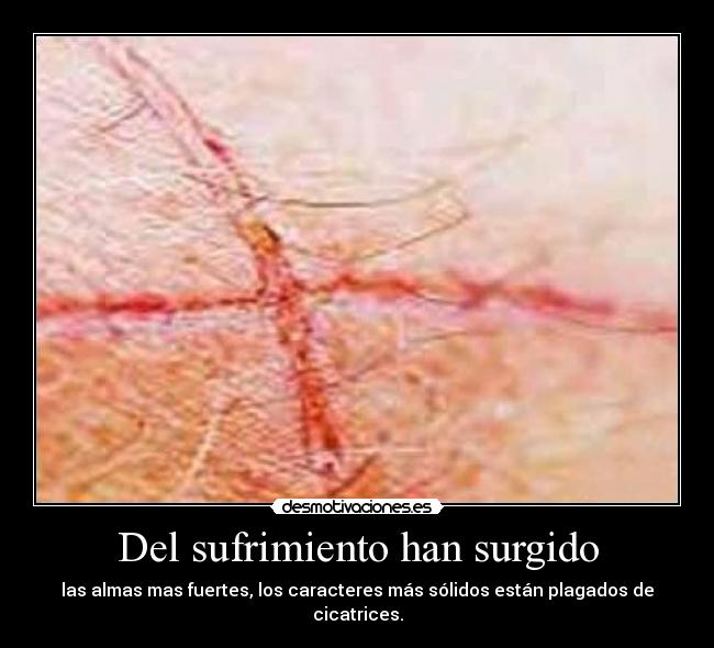 Del sufrimiento han surgido - las almas mas fuertes, los caracteres más sólidos están plagados de cicatrices.