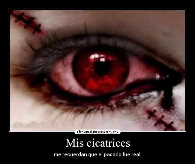 Mis cicatrices - me recuerdan que el pasado fue real.