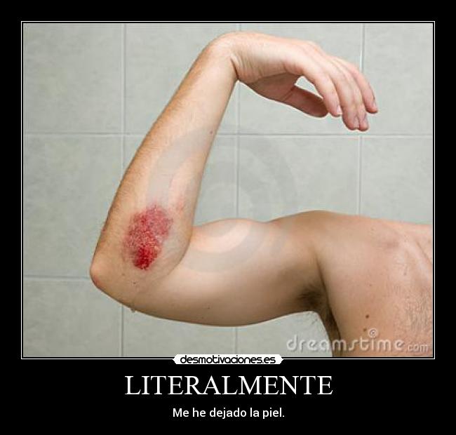 LITERALMENTE - 