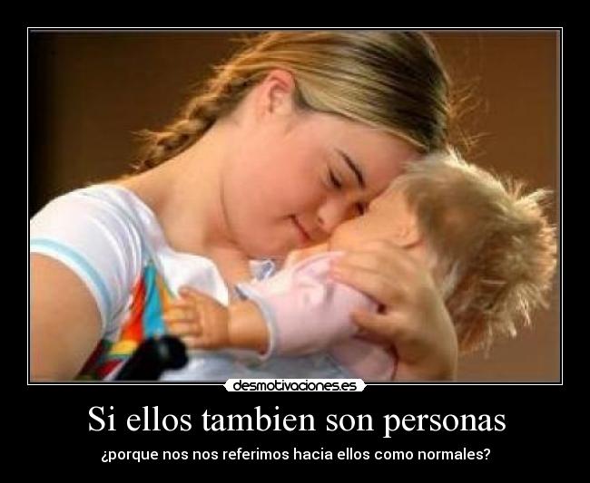 Si ellos tambien son personas - ¿porque nos nos referimos hacia ellos como normales?