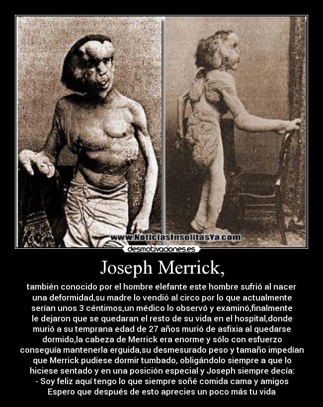 carteles joseph merrick hombre elefante vida desmotivaciones